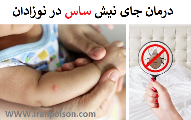 درمان جای نیش ساس در نوزادان