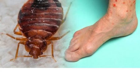 سم مخصوص تخم ساس تختخوابی