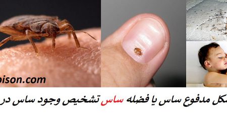 شکل مدفوع یا فضله ساس