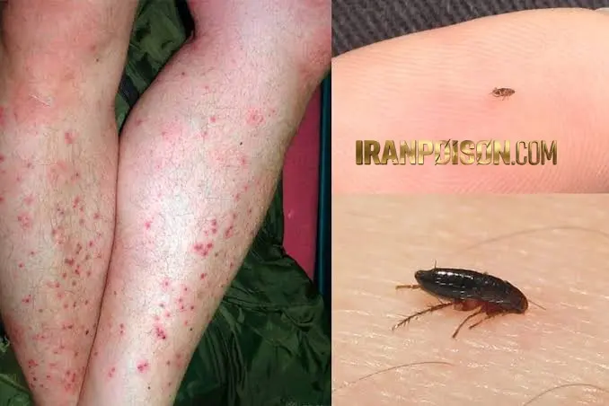 دو گونه مهم کک در این منطقه شناسایی شدند