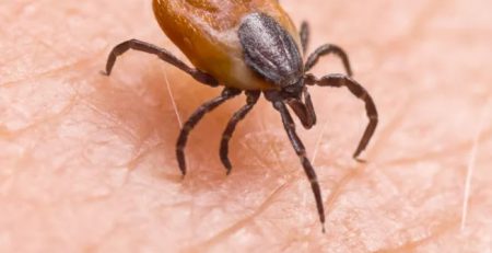 کنه روی دست