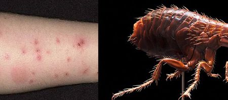 جای نیش کک چگونه هست؟