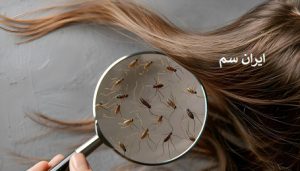 بررسی تخم شپش