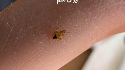 ساس ها پرواز میکنند؟