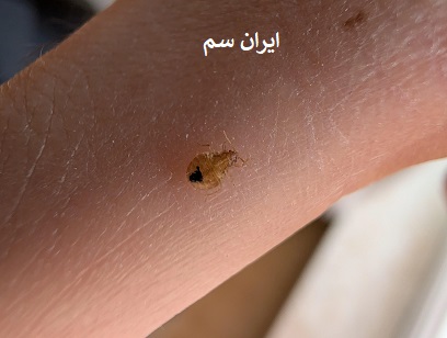 ساس ها پرواز میکنند؟