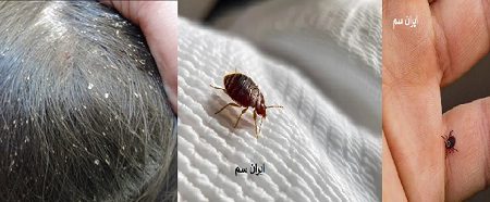 فرق بین شپش،ساس،کنه