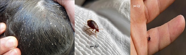 فرق بین شپش،ساس،کنه