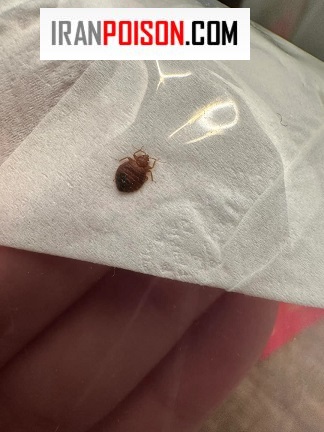 ساس باعث اختلال در خواب