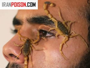 انسان تحمل نیش عقرب را دارد؟