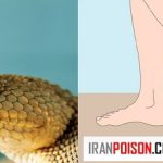 بعد از نیش زدن مار، انسان چند دقیقه زمان دارد تا خود را به بیمارستان برساند؟