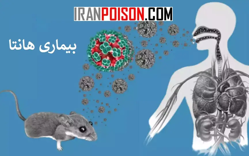 انواع بیماری و علائم بالینی هانتا ویروس موش- ایران سم