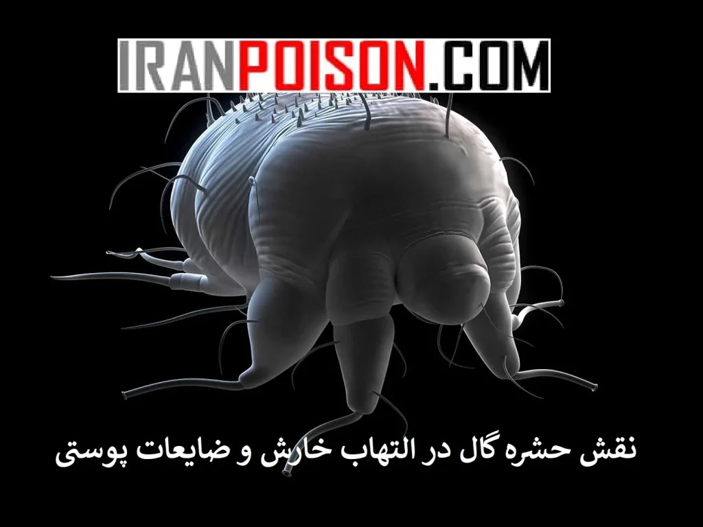 پیشگیری از گال- ایران سم
