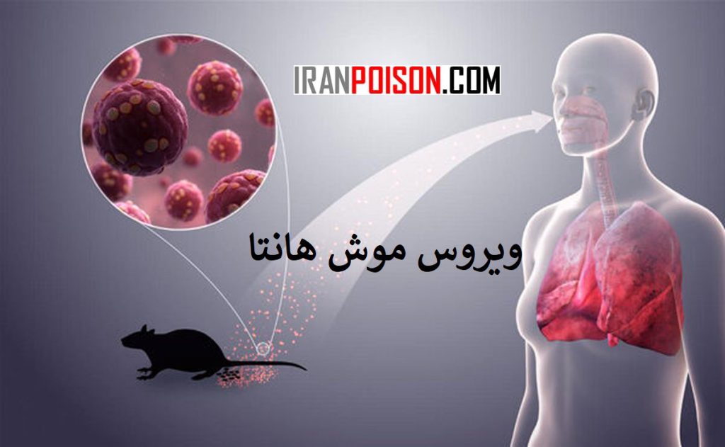 گفته های سازمان جهانی بهداشت در مورد ویروس موش هانتا- ایران سم