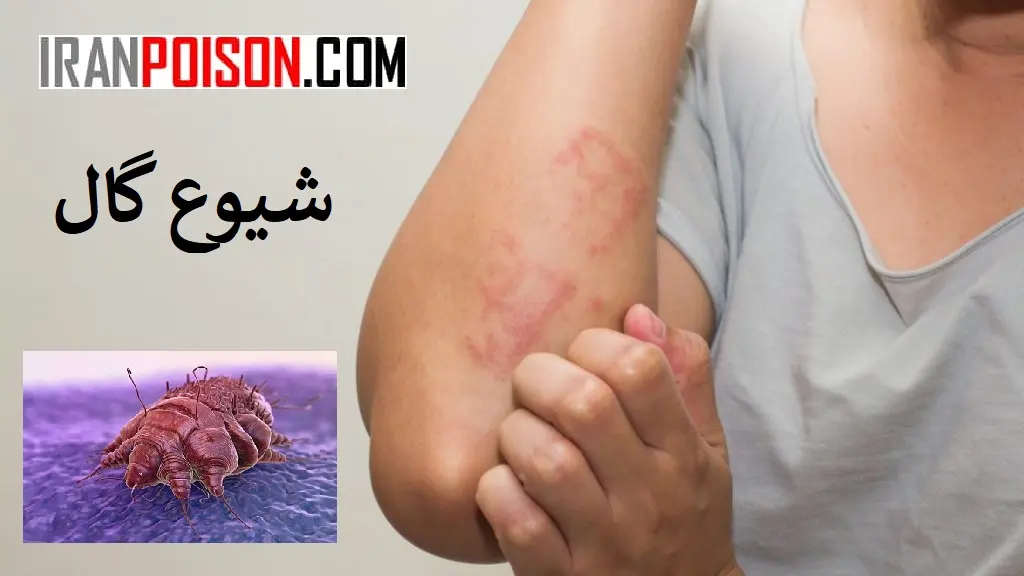 عوامل مؤثر بر شیوع بیماری گال- ایران سم