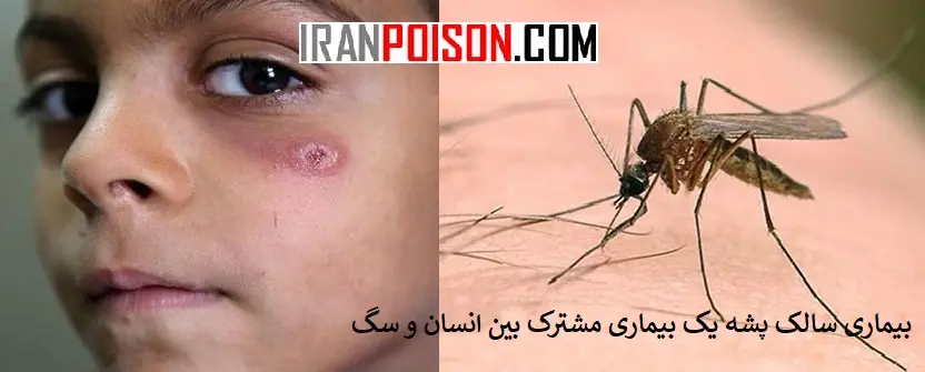 اهمیت آگاهی از بیماری سالک در استان گلستان- ایران سم