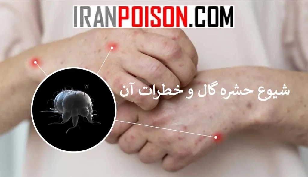 عوامل خطر در شیوع گال- ایران سم