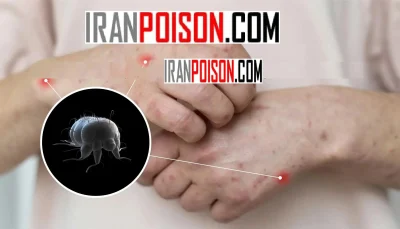 خرید سم گال مکس فورس